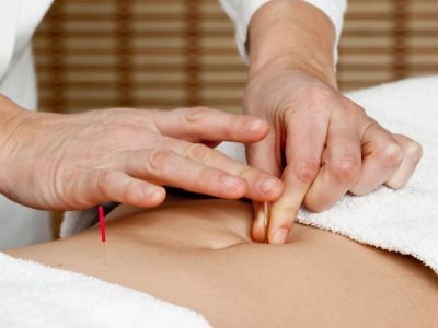 Why to Choose Body Acupuncture Treatments?