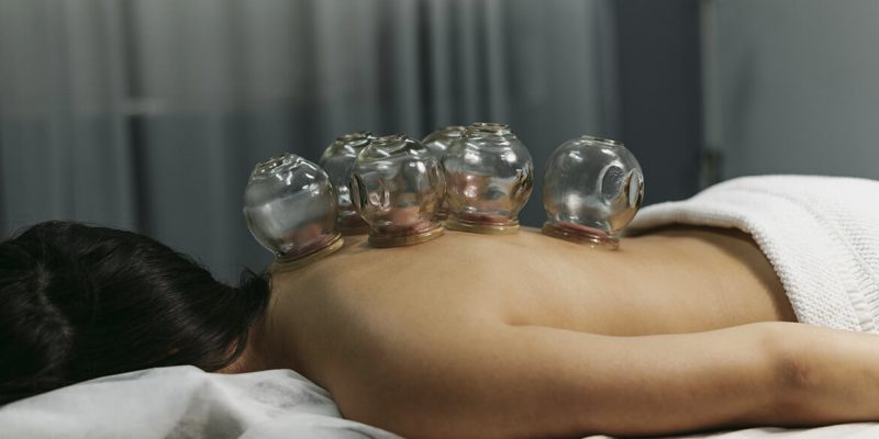 What is cupping and what are the benefits for you