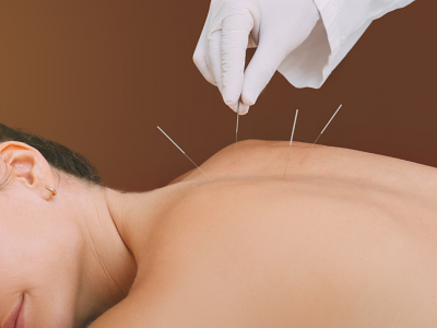 Discover the Healing Benefits of Acupuncture at Healflow